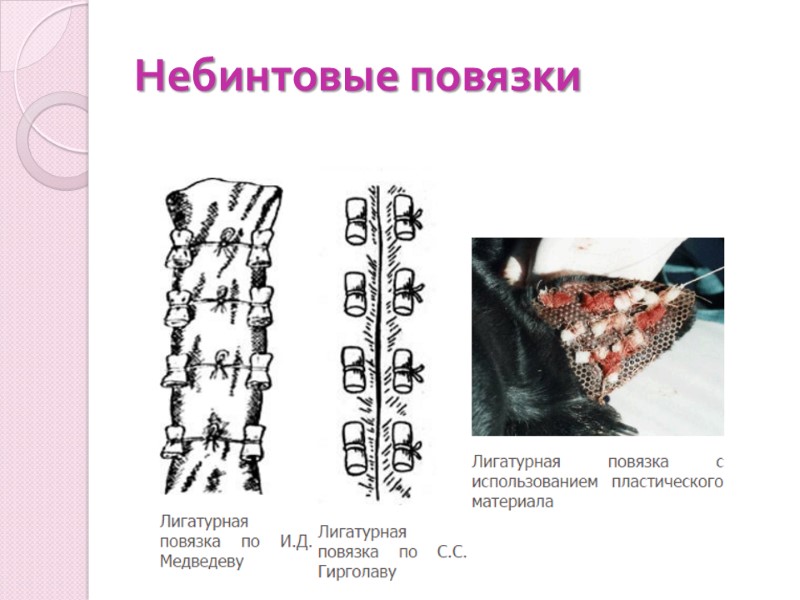 Небинтовые повязки